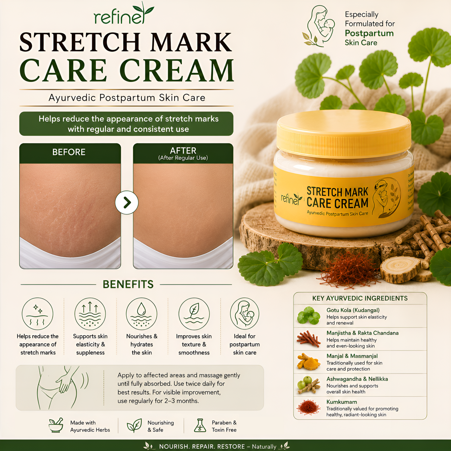 Refine Stretch Mark Care Cream - Ayurvedic Postpartum Skincare 100g